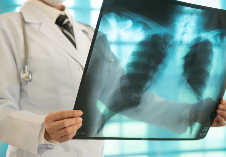 Comissões debatem impacto da doença pulmonar obstrutiva crônica na população idosa